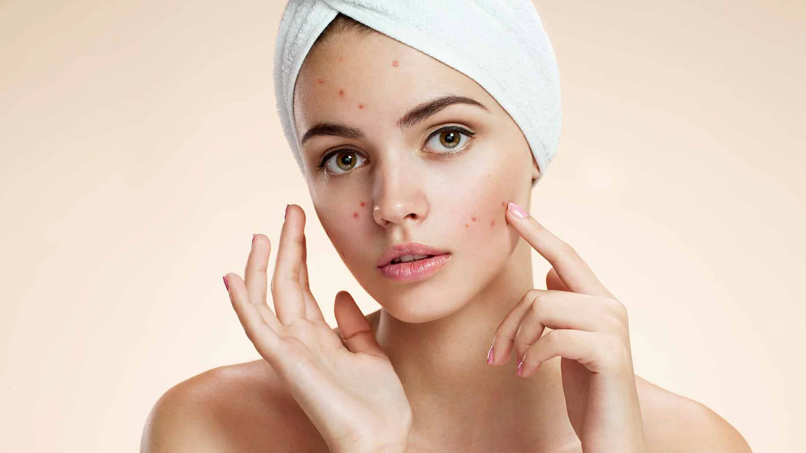 Acne and Scars Treatments